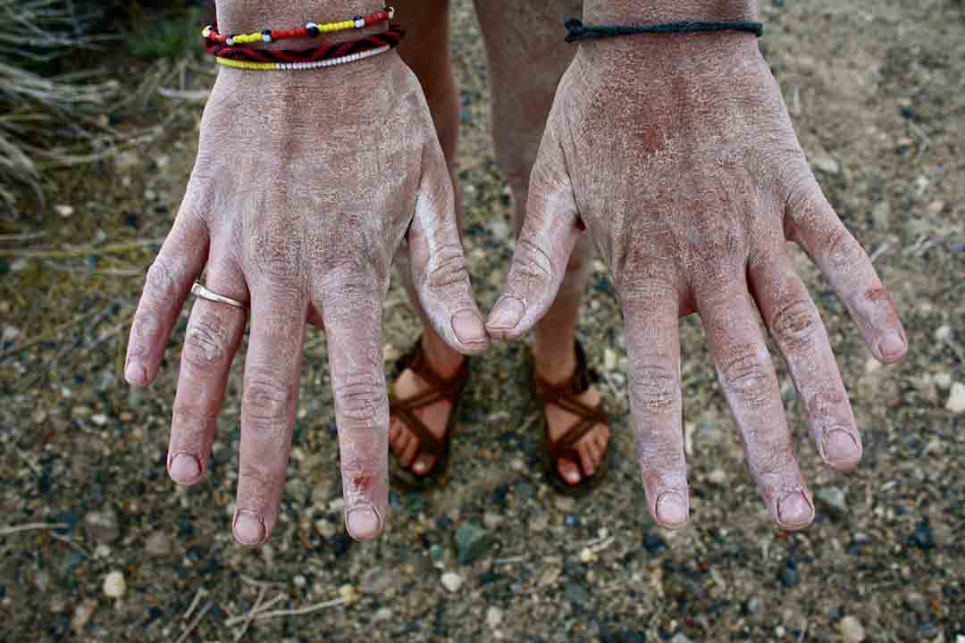 Salt on the hands of a woman who swam in Lake Mono